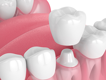 Summit Family Dental Arts