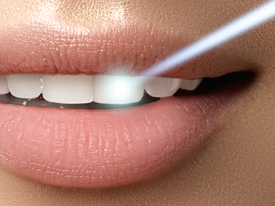 Summit Family Dental Arts | Dermal Fillers, Pediatric Dentistry and Ceramic Crowns